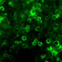 Dissociated cell cultures of an e13 mouse brain showing Netrin-1 (green staining) in neuronal precursor cells.