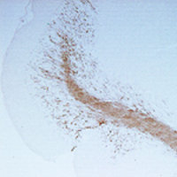 A tissue section through an adult mouse brain showing CNPase (brown staining) in white matter tracts and the granule cell layer of the cerebellum.