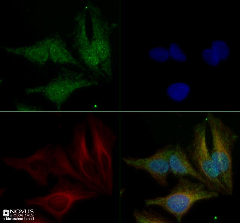 OPA1 Immunocytochemistry/Immunofluorescence