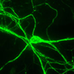 NF-H-positive cultured neuron (green) from a neonatal mouse brain. Protocol on datasheet