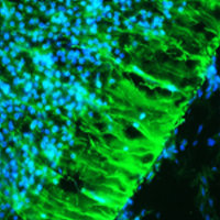 A tissue section through an e13 mouse brain showing Nestin (green staining) in neural stem cells of the ventricular zone of the CNS. DAPI (blue staining) allows visualization of nuclei.