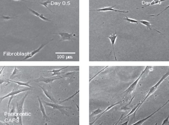 Optical microscope imaging of FBs and CAFs cultured on collagen substrates of different concentration.